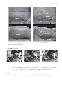 上肢運動器疾患のリハビリテーション[Web動画付]: 関節機能解剖